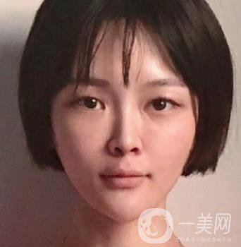 石家莊市醫(yī)院整形美容外科價(jià)格表2020，附雙眼皮實(shí)例