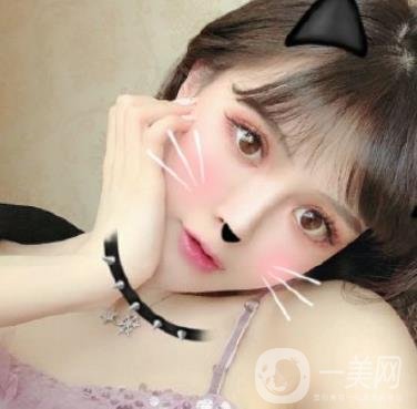 石家莊市醫(yī)院整形美容外科價(jià)格表2020，附雙眼皮實(shí)例