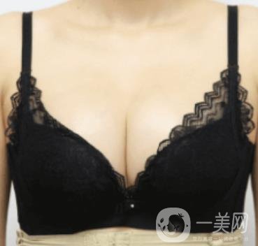 上海美貝爾明橋醫(yī)院價(jià)格(目)一覽表，附孫超醫(yī)生隆胸經(jīng)驗(yàn)分享