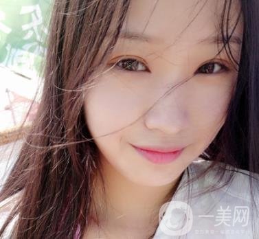 北大醫(yī)院美容價格表，附自體脂肪填充面部前后照