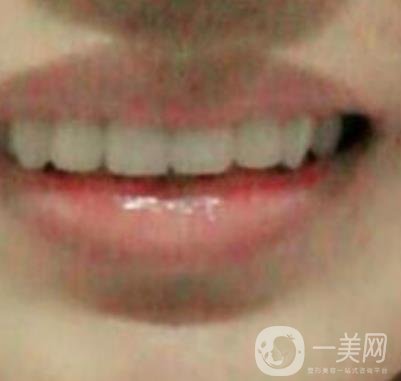 北京醫(yī)院整牙