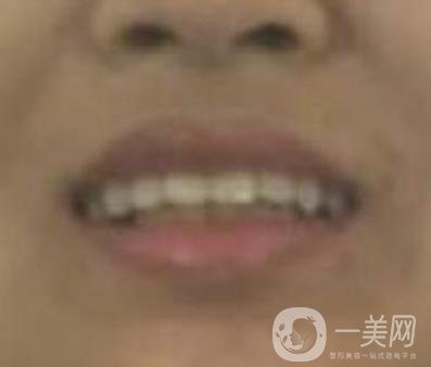 北京醫(yī)院整牙