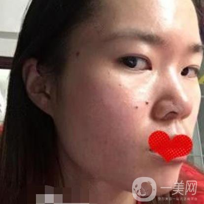 廣州荔灣區(qū)人民醫(yī)院*