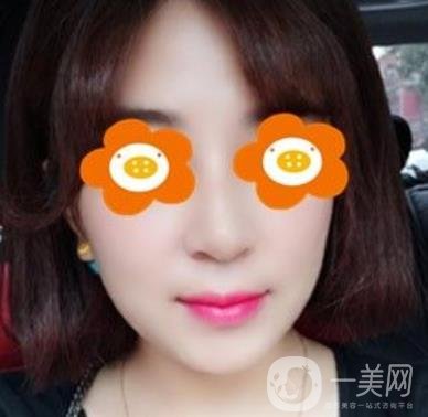 長沙貝美醫(yī)院做鼻子怎么樣?一覽價格表費用詳情