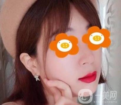 長沙貝美醫(yī)院做鼻子怎么樣?一覽價格表費用詳情