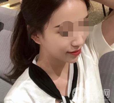 重慶附一院整形科價(jià)格表2020年公布，附祛痣整形日記