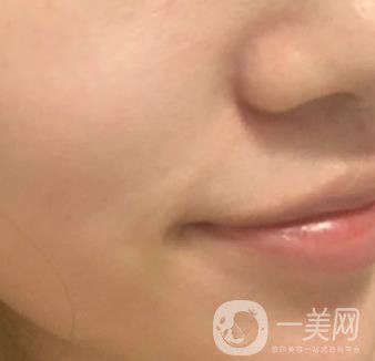 重慶附一院整形科價(jià)格表2020年公布，附祛痣整形日記