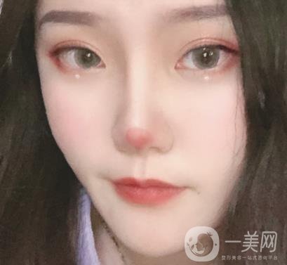 杭州市第三醫(yī)院整形價(jià)格表及*案例一覽