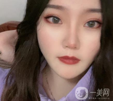 杭州市第三醫(yī)院整形價(jià)格表及*案例一覽