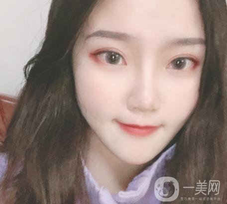 杭州市第三醫(yī)院整形價(jià)格表及*案例一覽