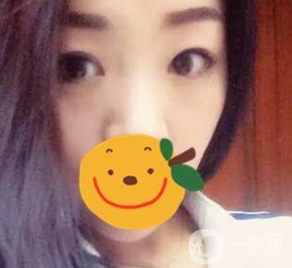 昆明市第一人民醫(yī)院雙眼皮多少錢？附案例及2020全新整形價(jià)格表