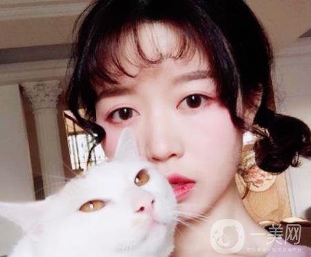 劉波醫(yī)生隆鼻修復