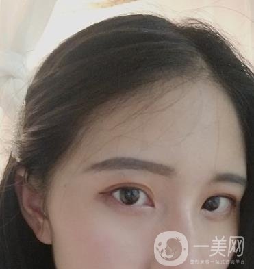 布仁醫(yī)生隆鼻