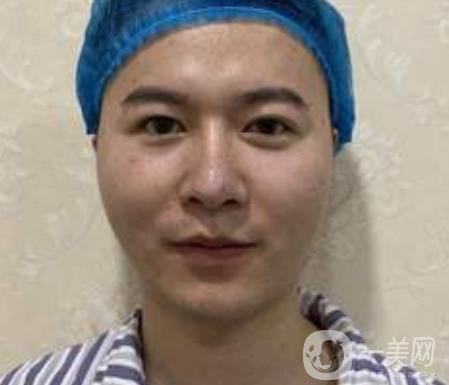 邱健欽醫(yī)生隆鼻