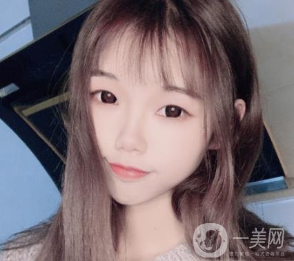 上海時(shí)光醫(yī)院何晉龍磨骨怎么樣？價(jià)格表及術(shù)后*果分享