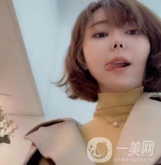 西南醫(yī)院美容整形科打*多少錢？價(jià)格表及案例*果