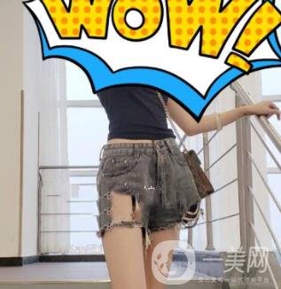 中南大學第一醫(yī)院整形美容科價格表*新發(fā)布,附全身吸脂*果分享