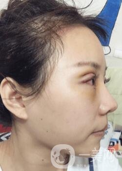 蘭大二院整形外科價(jià)格表2020，附雙眼皮整形日記