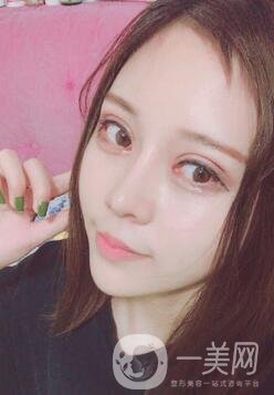 蘭大二院整形外科價(jià)格表2020，附雙眼皮整形日記