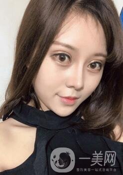 蘭大二院整形外科價(jià)格表2020，附雙眼皮整形日記