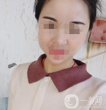 北京醫(yī)院整形科繡眉*果怎么樣?2020年價(jià)格表日常收費(fèi)詳情一覽