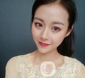 上海華美醫(yī)療美容醫(yī)院價格表，附雙眼皮修復(fù)案例