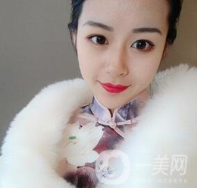 上海華美醫(yī)療美容醫(yī)院價格表，附雙眼皮修復(fù)案例