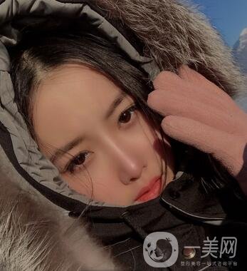 廣州曙光醫(yī)學(xué)美容醫(yī)院價(jià)格表及肋軟骨隆鼻案例分享