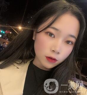 西安高一生醫(yī)療美容醫(yī)院價格表，附面部吸脂案例分享