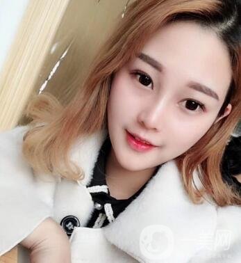 成都銅雀臺整形醫(yī)院隆鼻案例分享，附全新價格表