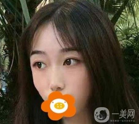 南京美貝爾整形醫(yī)院做*好不好？?jī)r(jià)格表費(fèi)用明細(xì)和*果圖參考