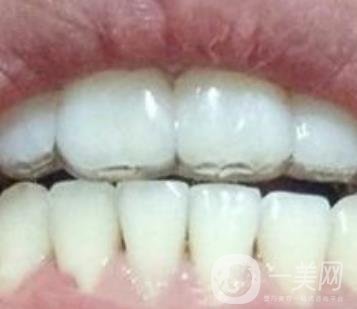 貴州口腔醫(yī)院正畸醫(yī)生信息介紹?內(nèi)含牙齒美容項目價格表及案例