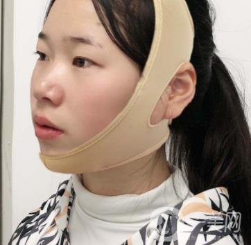 南京鼓樓醫(yī)院整形科價(jià)格表（價(jià)格）,及磨骨阿案例日記分享