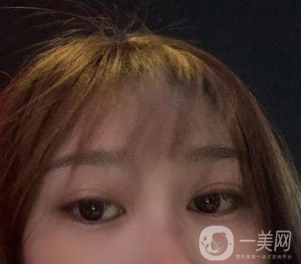 青島新陽(yáng)光婦產(chǎn)醫(yī)院縮陰手術(shù)恢復(fù)經(jīng)歷和價(jià)格價(jià)目表一覽