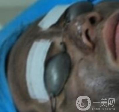 上海星和醫(yī)美整形醫(yī)院*祛斑*果圖和價(jià)格價(jià)目表2020年