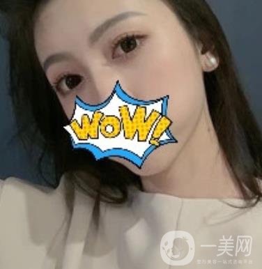 武漢艾萊美醫(yī)療整形醫(yī)院價格表項目收費明細，附雙眼皮案例