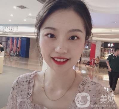 北京知音醫(yī)療美容熱瑪吉*果怎么樣？貴嗎？收費價格表2020公布