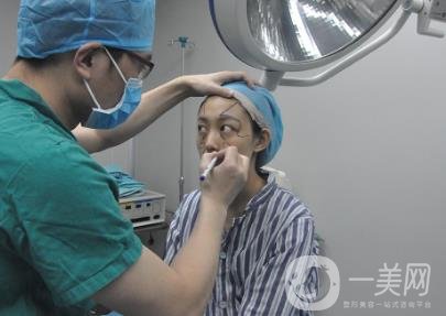 成都美容整形醫(yī)院做脂肪填充全臉*果靠譜嗎?近期價(jià)格表和案例參考