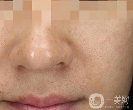 寧波第一醫(yī)院整形美容科價(jià)格表（價(jià)格）新版發(fā)布,及*案例*果