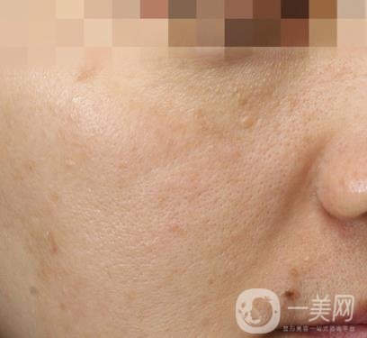 寧波第一醫(yī)院整形美容科價(jià)格表（價(jià)格）新版發(fā)布,及*案例*果