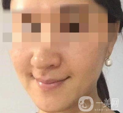 寧波第一醫(yī)院整形美容科價(jià)格表（價(jià)格）新版發(fā)布,及*案例*果