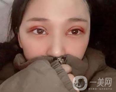 恩施州中心醫(yī)院美容整形科怎么樣？價格表和雙眼皮整形經(jīng)歷分享