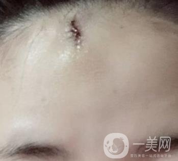 南昌二附院整形美容科價格表及祛痣日志公開，速覽