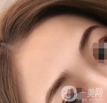 南昌二附院整形美容科價格表及祛痣日志公開，速覽