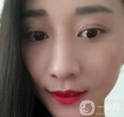 安醫(yī)一附院整形外科價(jià)格表2020版，還有激光祛斑案例