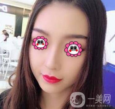 沈陽杏林崔昌墉做鼻子怎么樣?2020整形價格表一覽