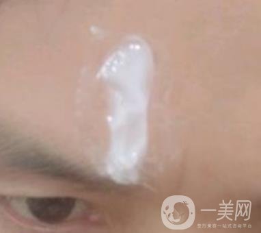 鄭大一附院祛疤怎樣?附2020整形價(jià)格表及案例*果圖