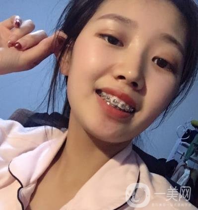 廣州曙光醫(yī)院整牙