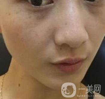 青醫(yī)附院整形美容科價格表及祛斑案例公布，速覽