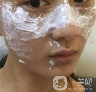 青醫(yī)附院整形美容科價格表及祛斑案例公布，速覽